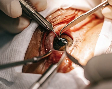 Orbit and lid surgery procedure at Susanjeevani Hospital, the top eye care hospital in Lucknow